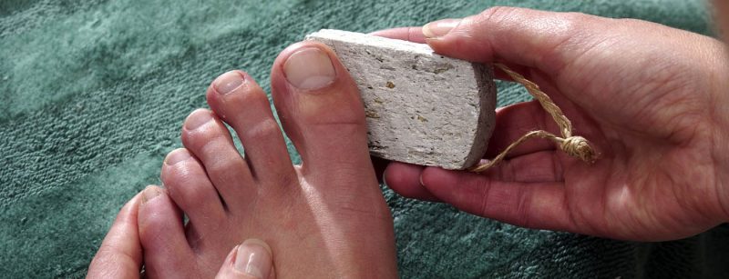 fuss_fusspflege_diabetes_hornhaut