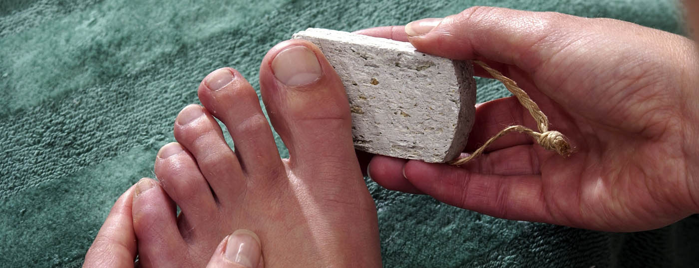 fuss_fusspflege_diabetes_hornhaut