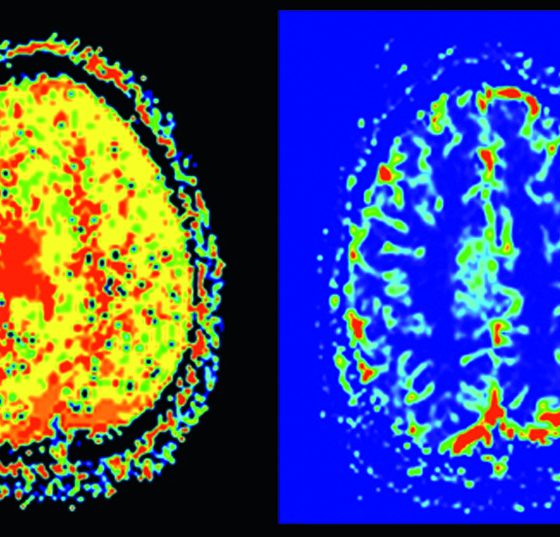 header_neuroimages_np1-15