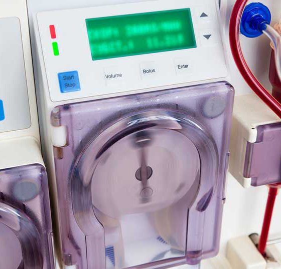 dialyse_blutwasche_niere