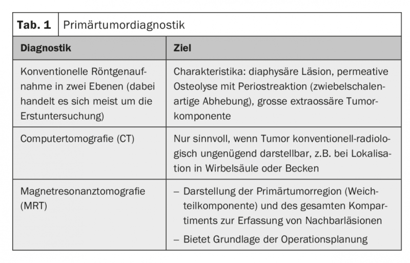 Management of the second most common primary malignant bone tumor ...