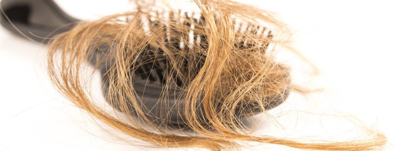 haarausfall_116489512_m