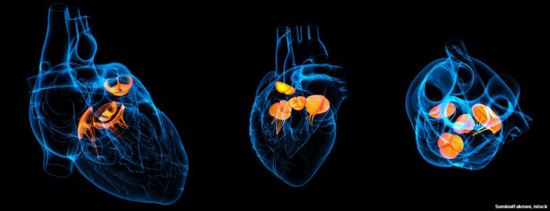 herzklappen_istock-629840910