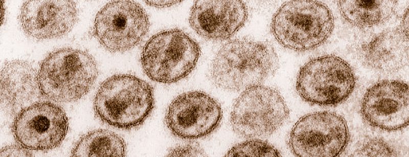 hiv-1_transmission_electron_micrograph_aids02bbb_lores