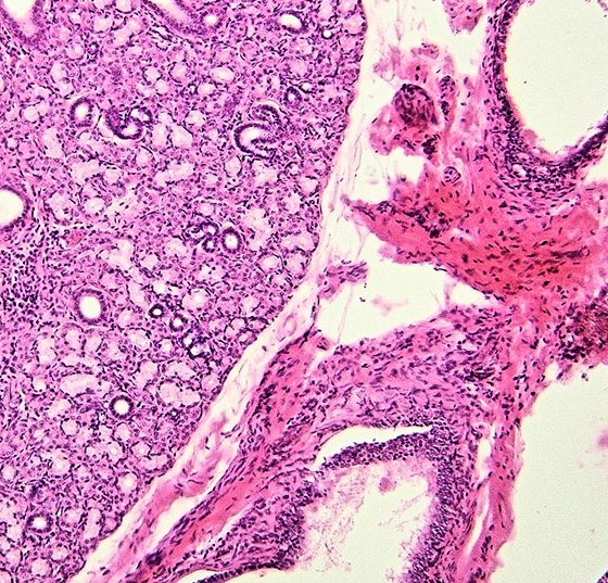 speicheldruese_istock-508860016