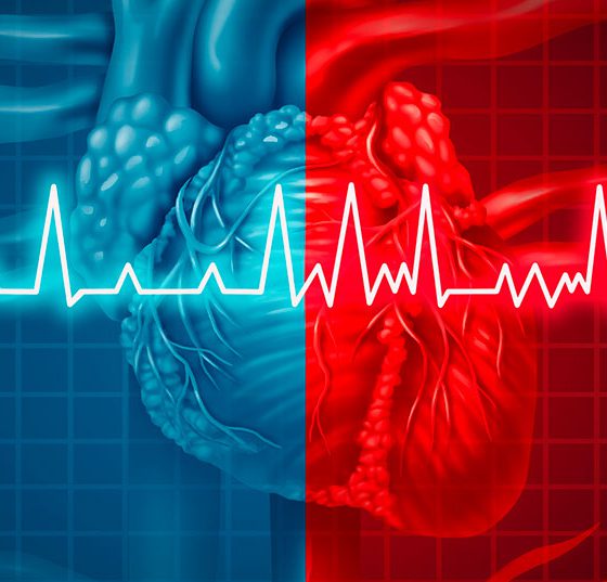 ekg_vorhofflimmern_istock-947331372