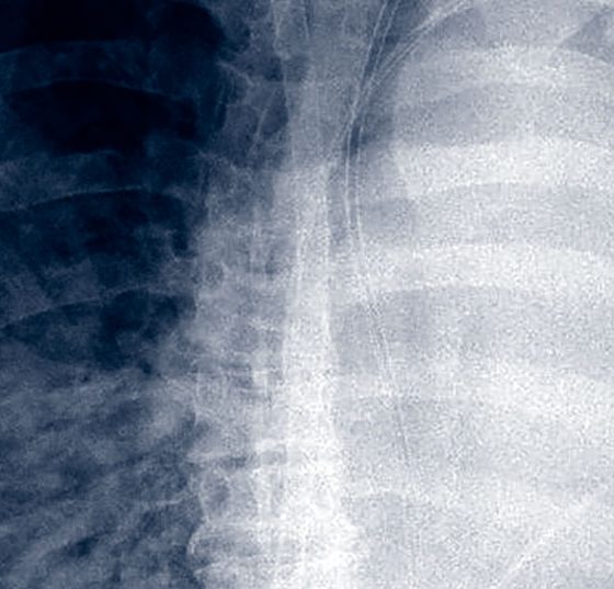abbildung-4-fobi-swiss