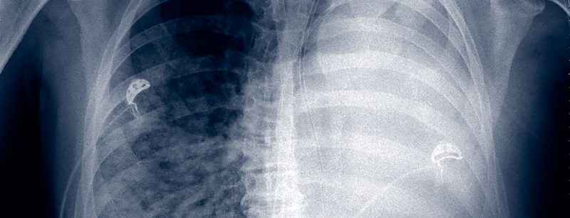 abbildung-4-fobi-swiss