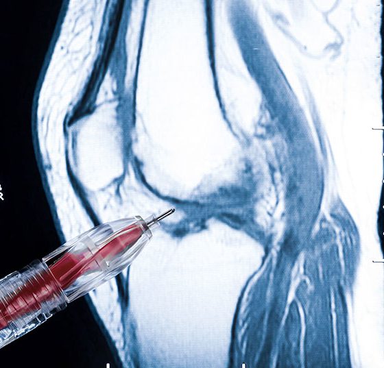 knie_istock-162258590