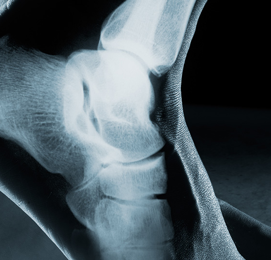 fuss_knoechel_istock-541847210_0