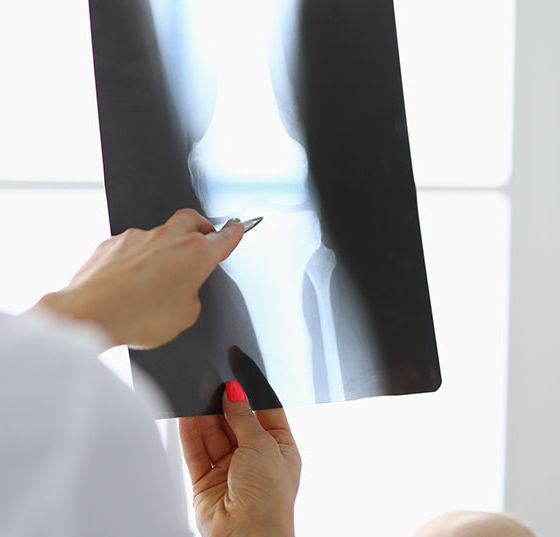 knie_istock-1286940824