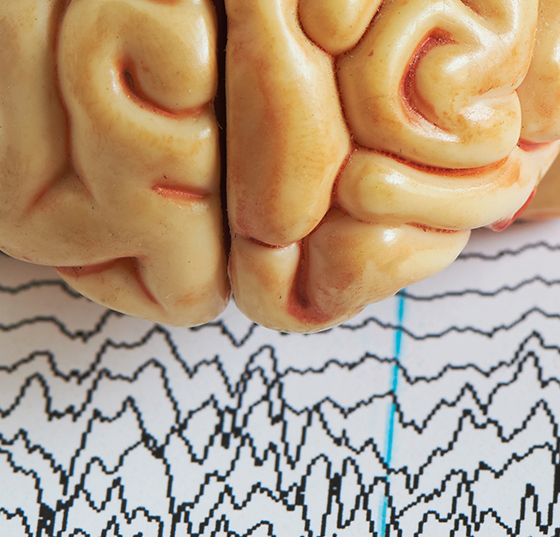 gehirn_gehirnwellen_istock-1019216984