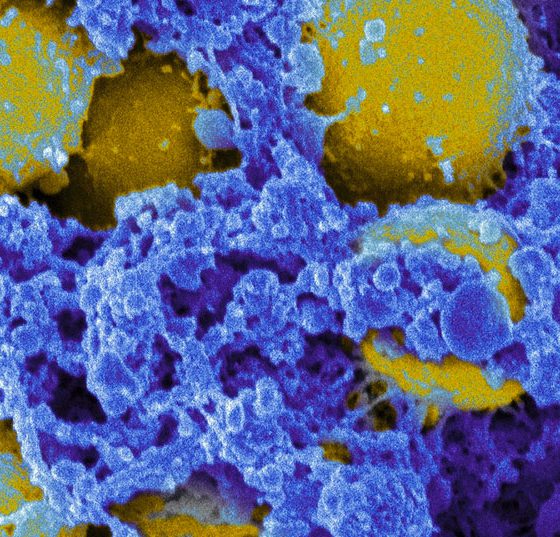 staphylococcus_aureus_bacteria_7739552618