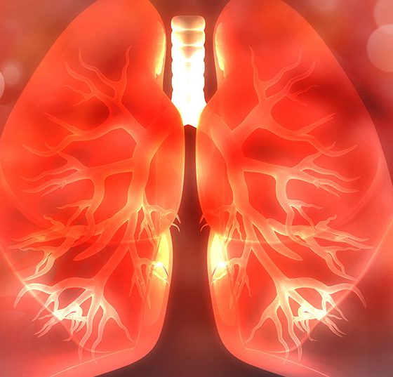 lunge_istock-1090820390