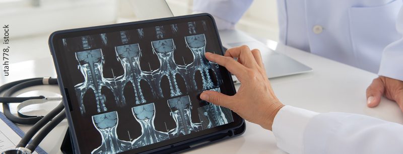 tumor_istock-1257153633