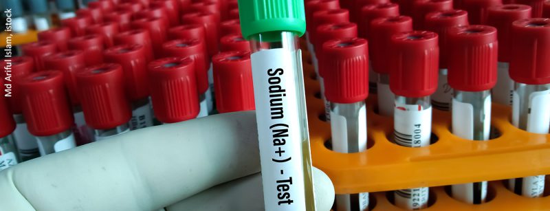 blut_natrium_istock-1340503120