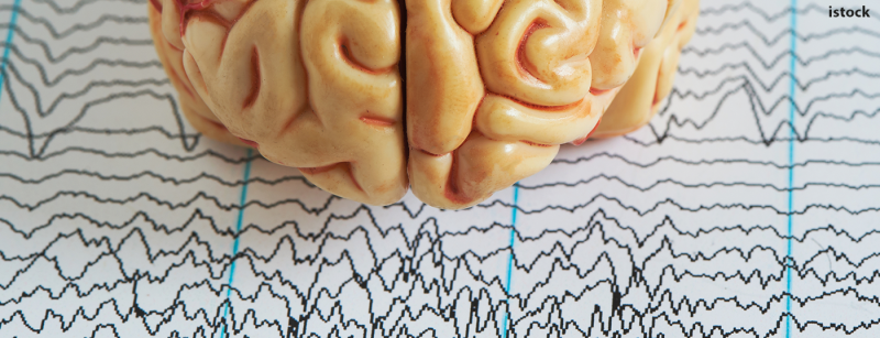 gehirn_gehirnwellen_istock-1019216984