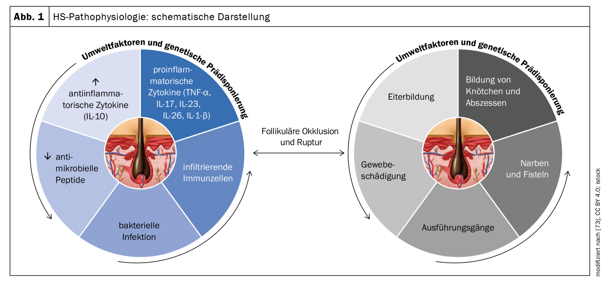 Etiopathogenesis, diagnosis and treatment - an update - Medizinonline
