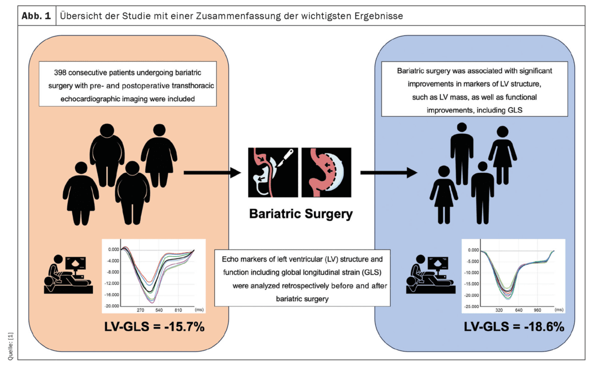 Effects of bariatric surgery on the structure and function of the left ...