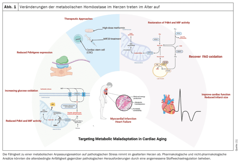 Cardiac metabolism in old age: effects and consequences - Medizinonline