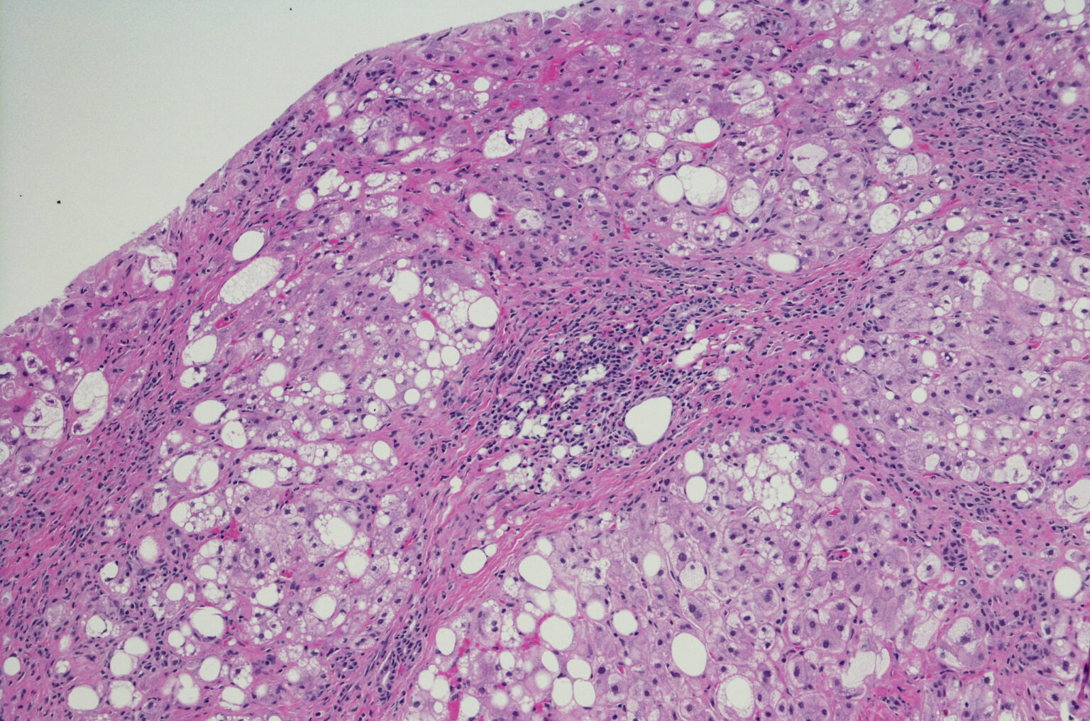 Diferenciación y activación de las células Th1 – un enfoque multiómico ...
